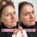 Microblading Warszawa Katarzyna von Engel Salon Velure