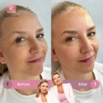 Microblading Warszawa Katarzyna von Engel