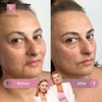 Microblading Warszawa Katarzyna von Engel