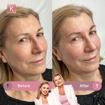 Microblading Warszawa Katarzyna von Engel Salon Velure