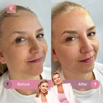 Microblading Warszawa Katarzyna von Engel